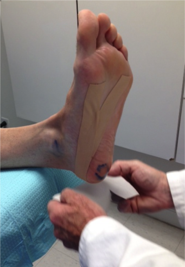 hip and heel pain together