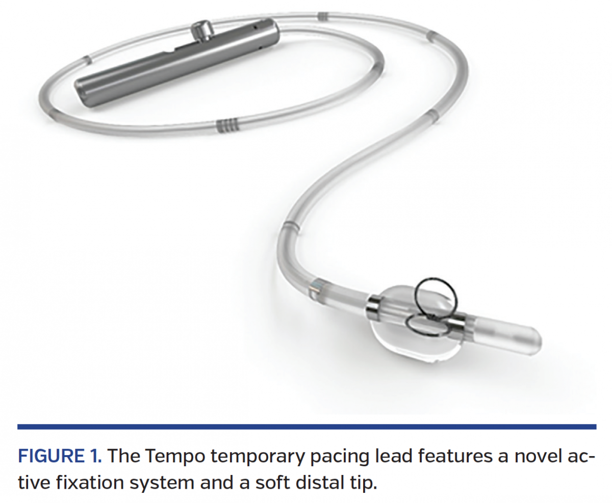 Safety and Feasibility of a Novel Active Fixation Temporary Pacing Lead