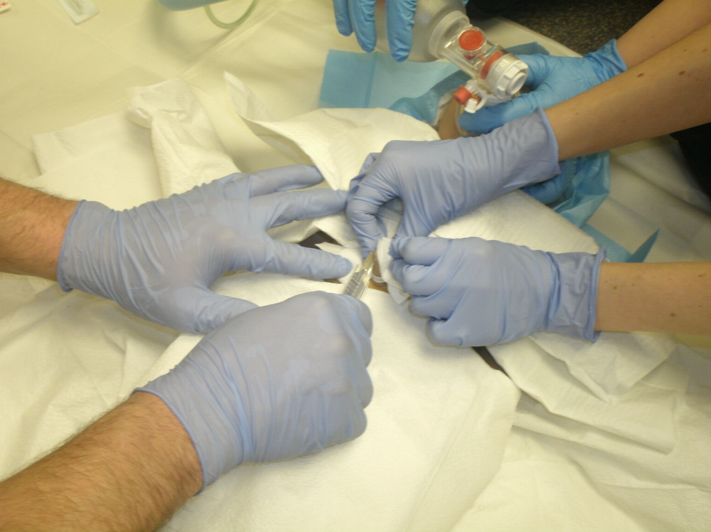 Umbilical Vein Catheterization in the Critical Newborn