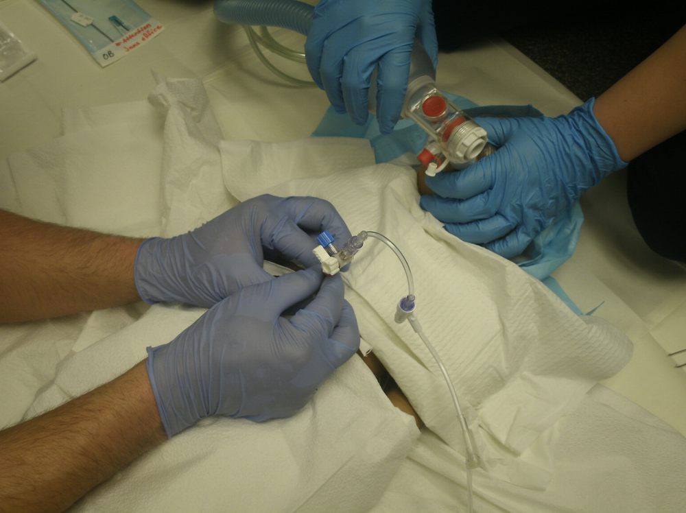 Umbilical Vein Catheterization in the Critical Newborn