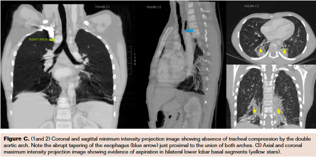 FIgure C
