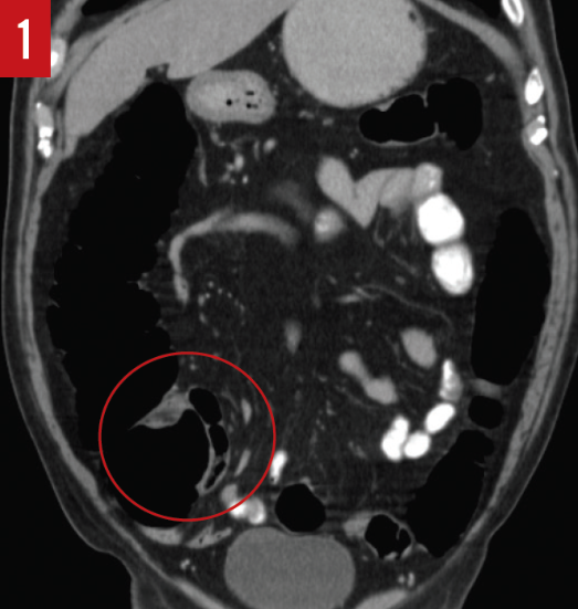 Interactive Case Report: Screening, Staging, and Assessment of ...