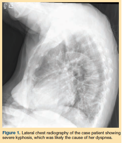 Improved Renal and Cognitive Function in a Hospice Patient After 
