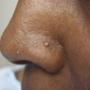 Derm DX