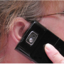 Figures 6 and 7. Nickel or Chromate allergy in cellphones Contact Dermatitis