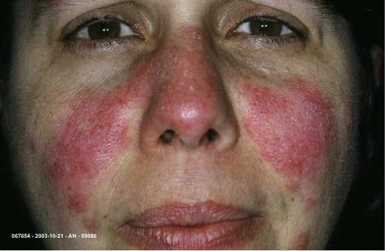 The Dermatologist’s Board Review-July