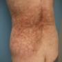 Derm DX