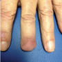 Derm DX