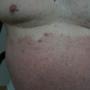 Derm DX