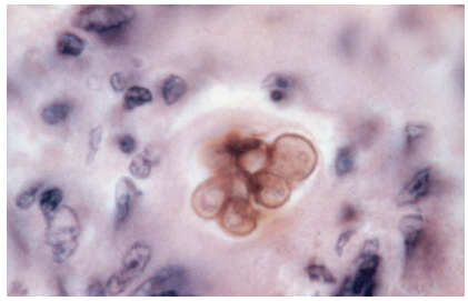 fungal slide