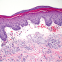 Derm DX