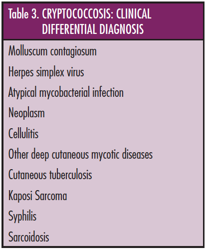 Treating Rare Fungal Infections: Cryptococcosis