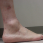 Derm DX
