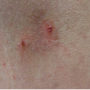 Derm DX
