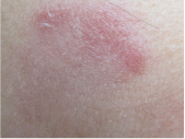 fig3