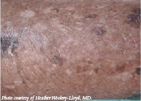 cutaneous