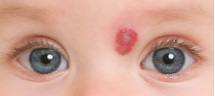 pediatric