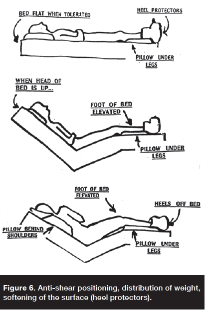 A Review of Deep Tissue Injury Development, Detection, and Prevention ...