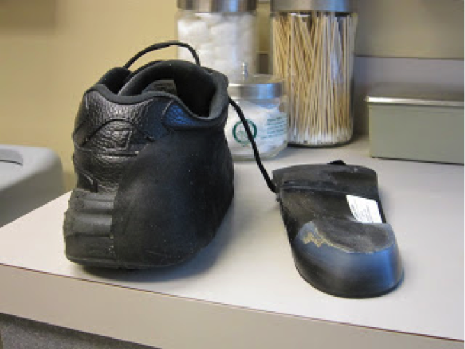 Modifying Shoes And Orthoses For Severe Lateral Ankle Instability
