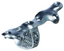 Patient Specific 3D Printed Bone Segments (Additive Orthopaedics)