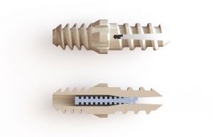 Vector™ Hammertoe Correction System