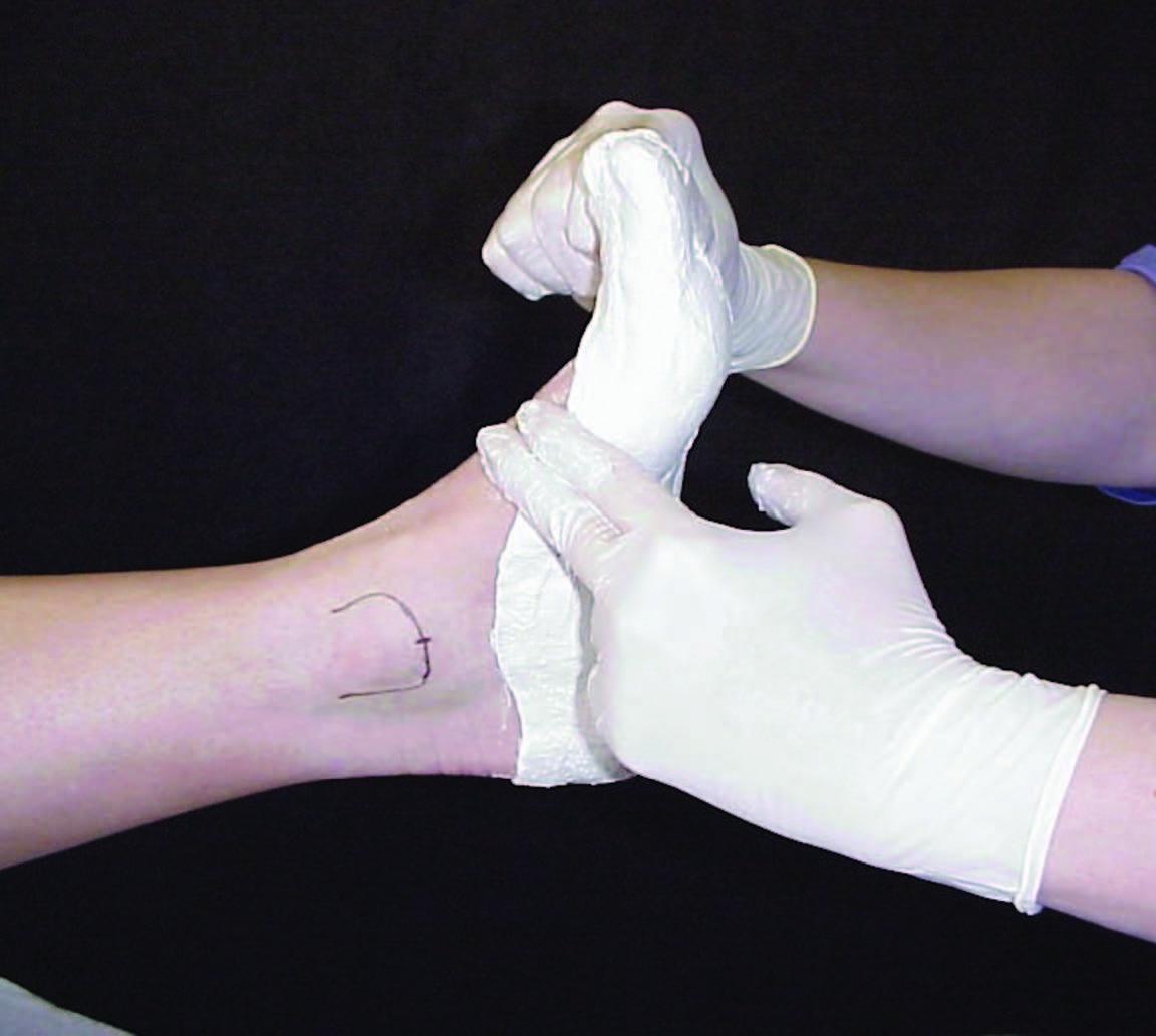 International Perspectives On Heel Pain