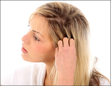 Itchy Scalp Hair Loss