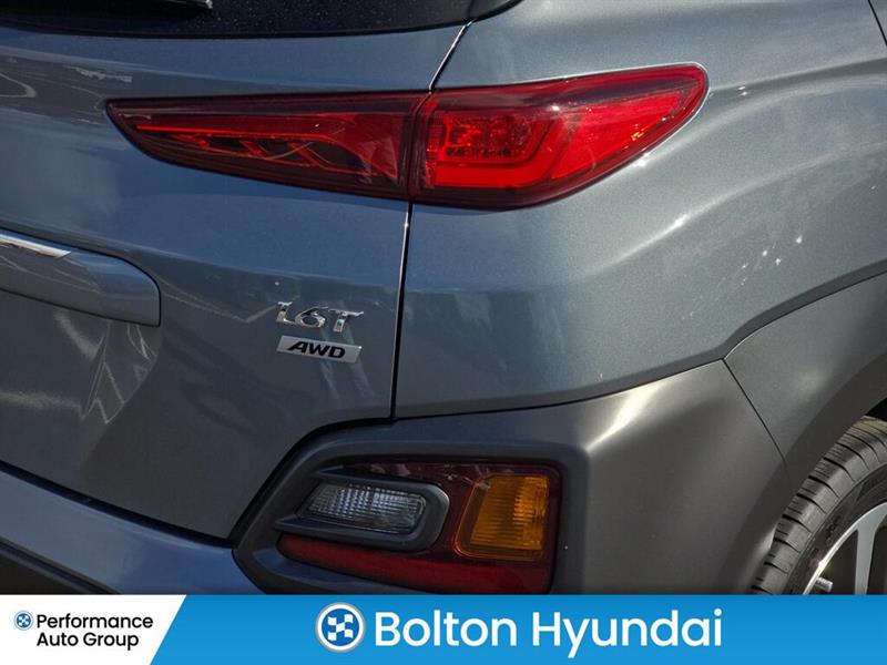 hyundai Kona 2018 - 9