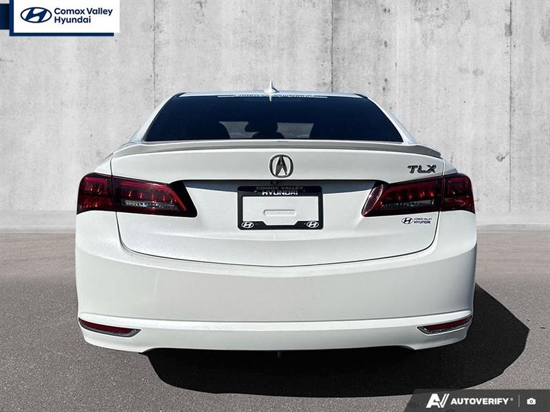 acura TLX 2015 - 5