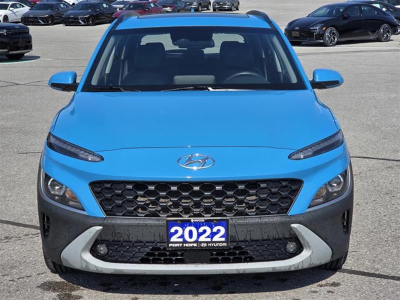 hyundai Kona 2022 - 3