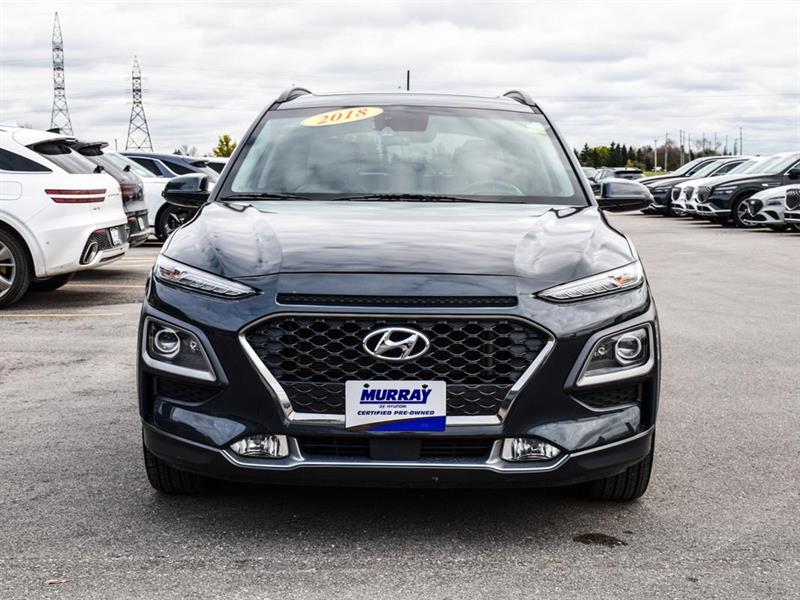 hyundai Kona 2018 - 3