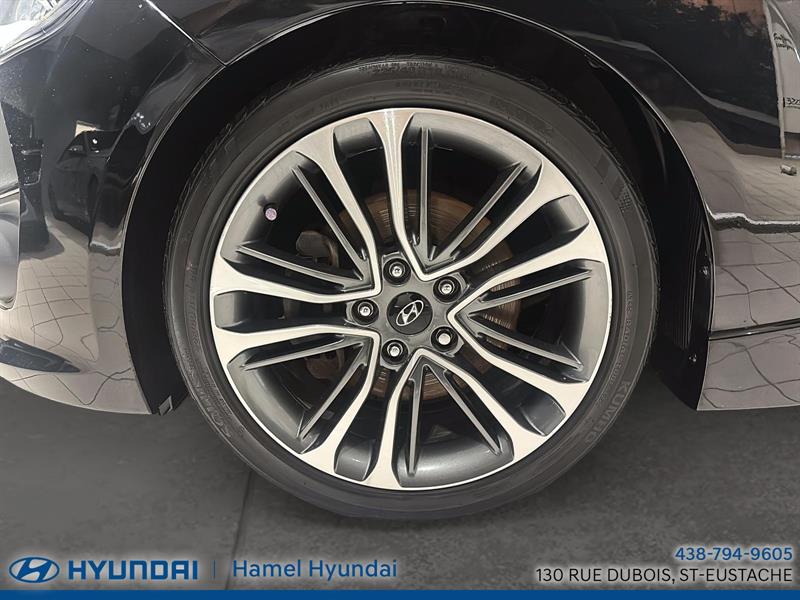 hyundai Veloster 2016 - 6