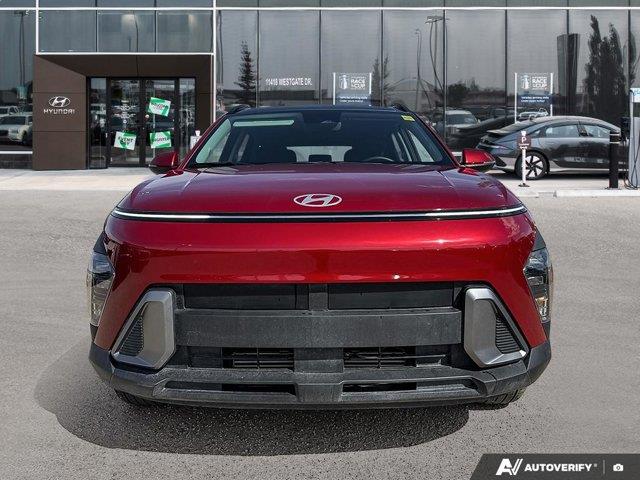 hyundai Kona 2025 - 5