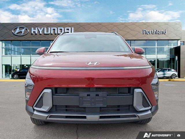 hyundai Kona 2025 - 8