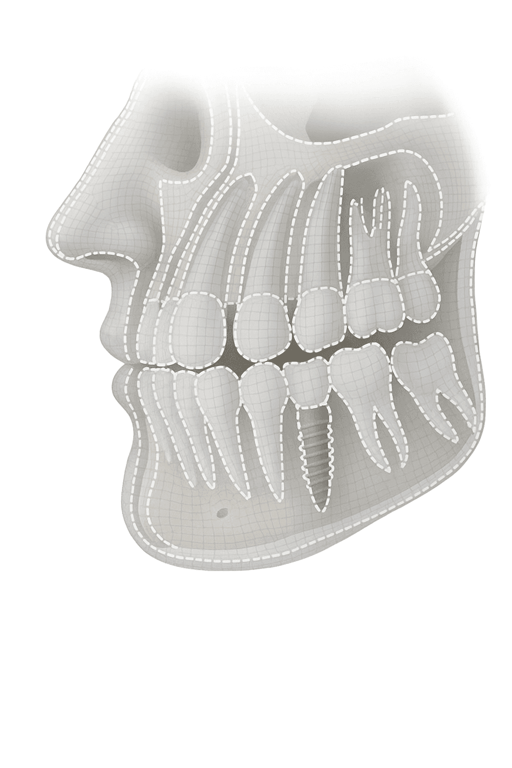Automatic Dental Segmentation