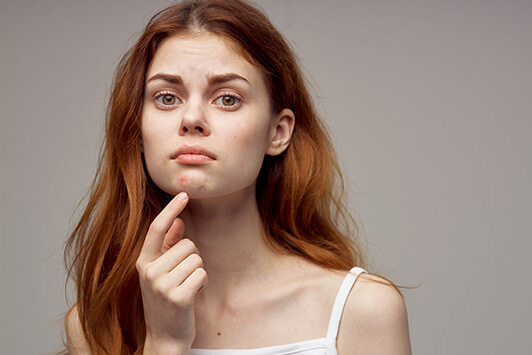 Skin Purging vs. Breaking Out Guide