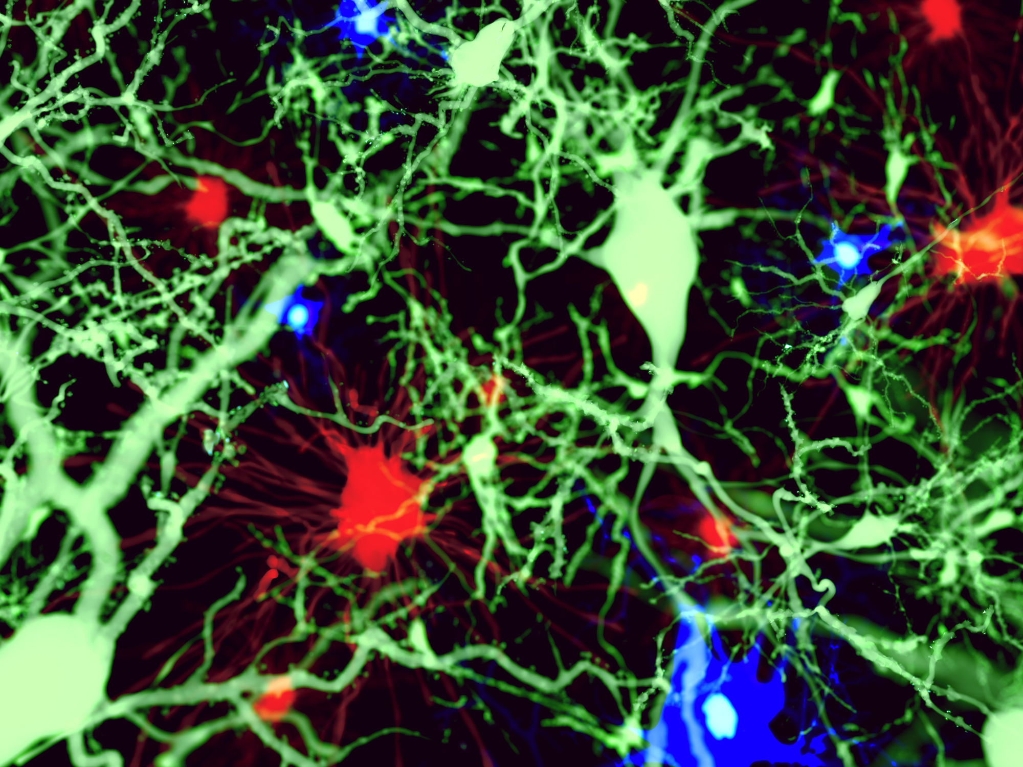 The Truth Behind The Autism Curve:  New Insights Revealed - ctq3013