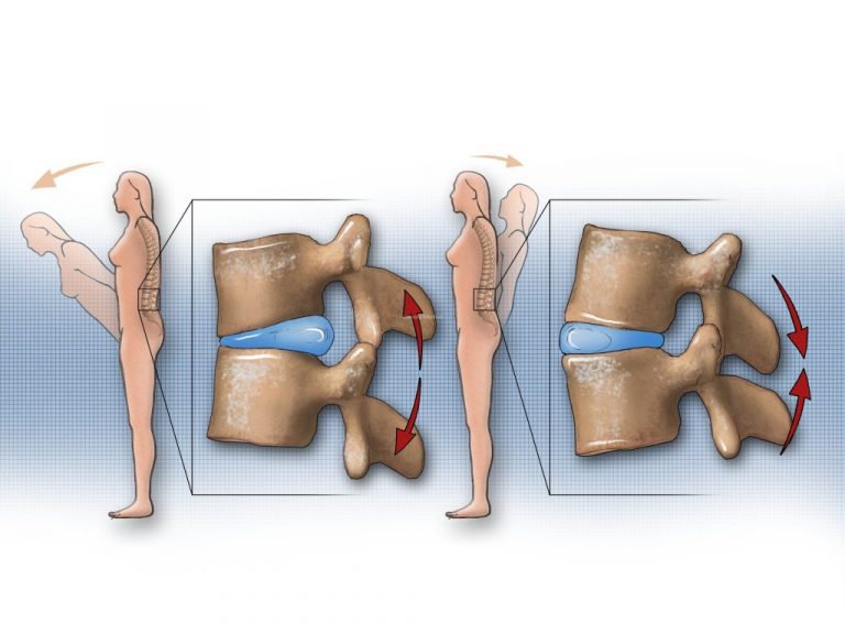 Mark Reinke What is "neutral spine" and why it is important for you