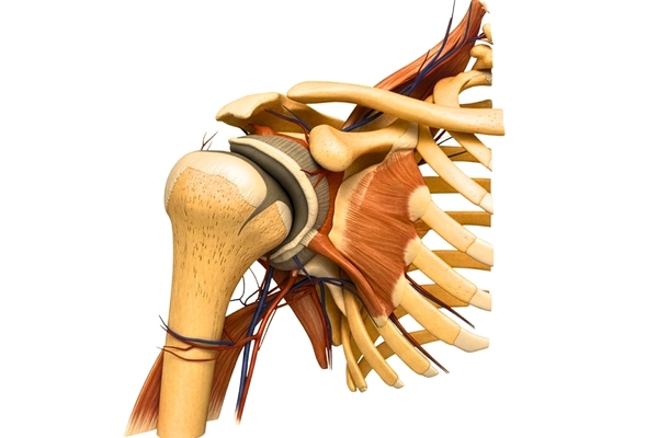 Tendinite de la coiffe des rotateurs à l’épaule : Symptômes et diagnostic