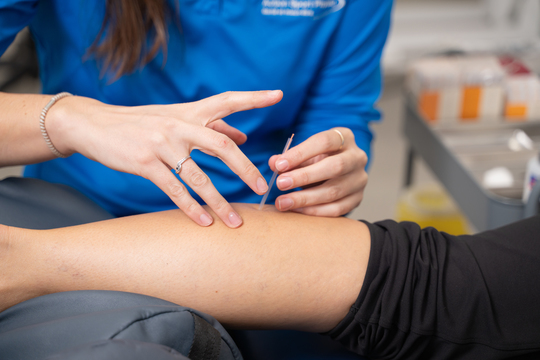 Photo du service de poncture physiothérapeutique avec aiguilles sèches