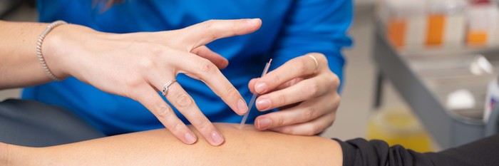 Puncture physiothérapique avec aiguilles sèches
