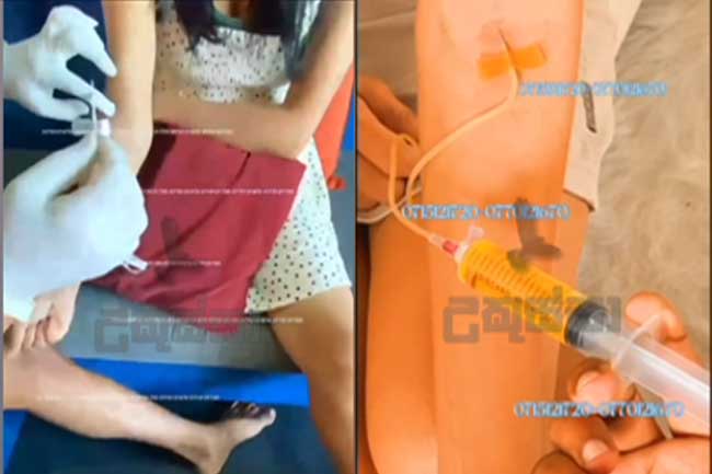 ලස්සන වෙන්න ලබාදෙන එන්නත ගැන උකුස්සා සියල්ල හෙළිකරයි