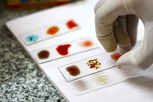 ලොව දුර්ලභ රුධිර වර්ගයක් සොයා ගනී