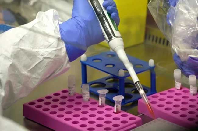 නීපා ගැන අනියත බියක් එපා - මෙරට සෞඛ්‍ය අංශ අවධානයෙන්