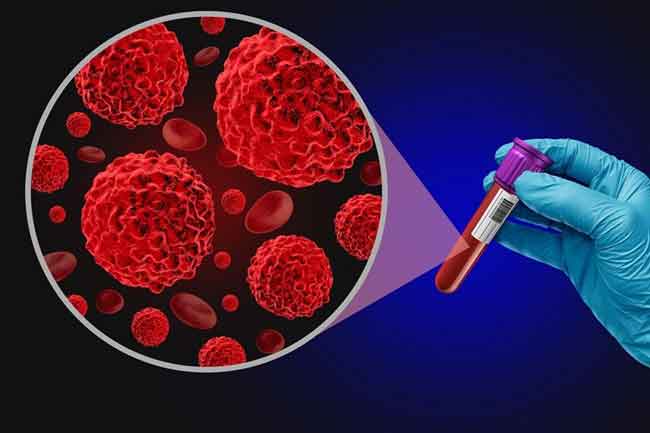 දිනකට නව පිළිකා රෝගීන් 100ක් හඳුනාගැනේ