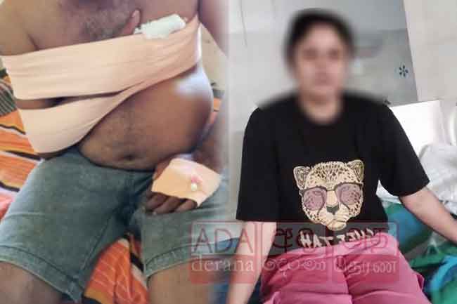 ඉපලෝගම මාලිමා මන්ත්‍රීගෙන් අඹුසැමි යුවළකට ප්‍රහාරයක්