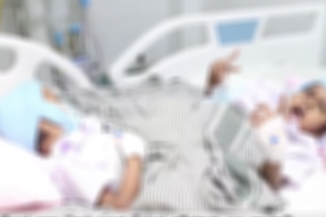 සිරුරෙන් බද්ධව සිටි දැරියන් සැත්කමකින් සාර්ථකව වෙන්කෙරේ 