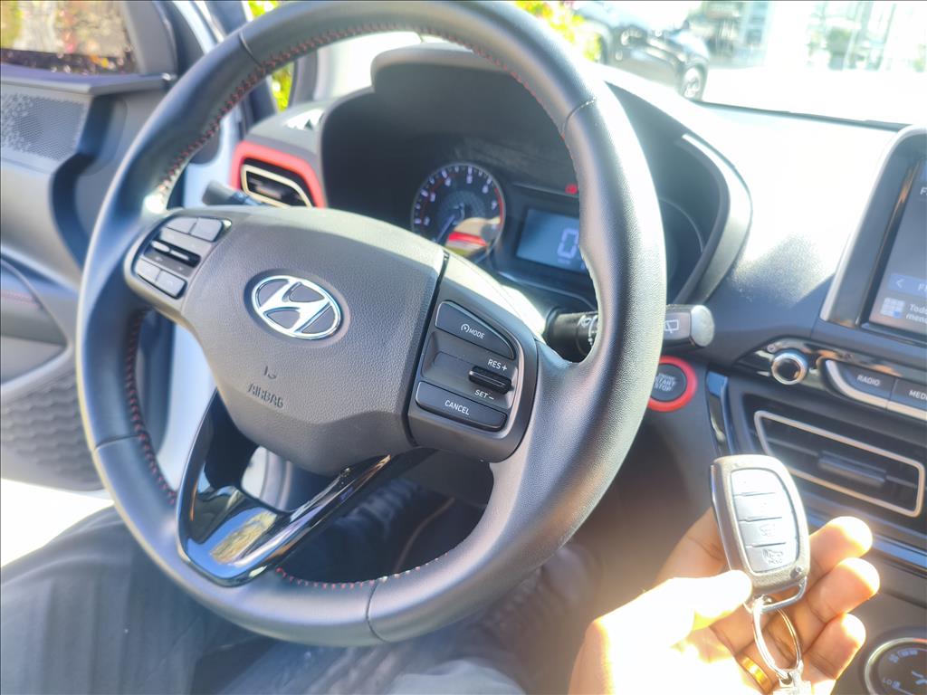 HB20X 1.6 16V FLEX DIAMOND AUTOMÁTICO14