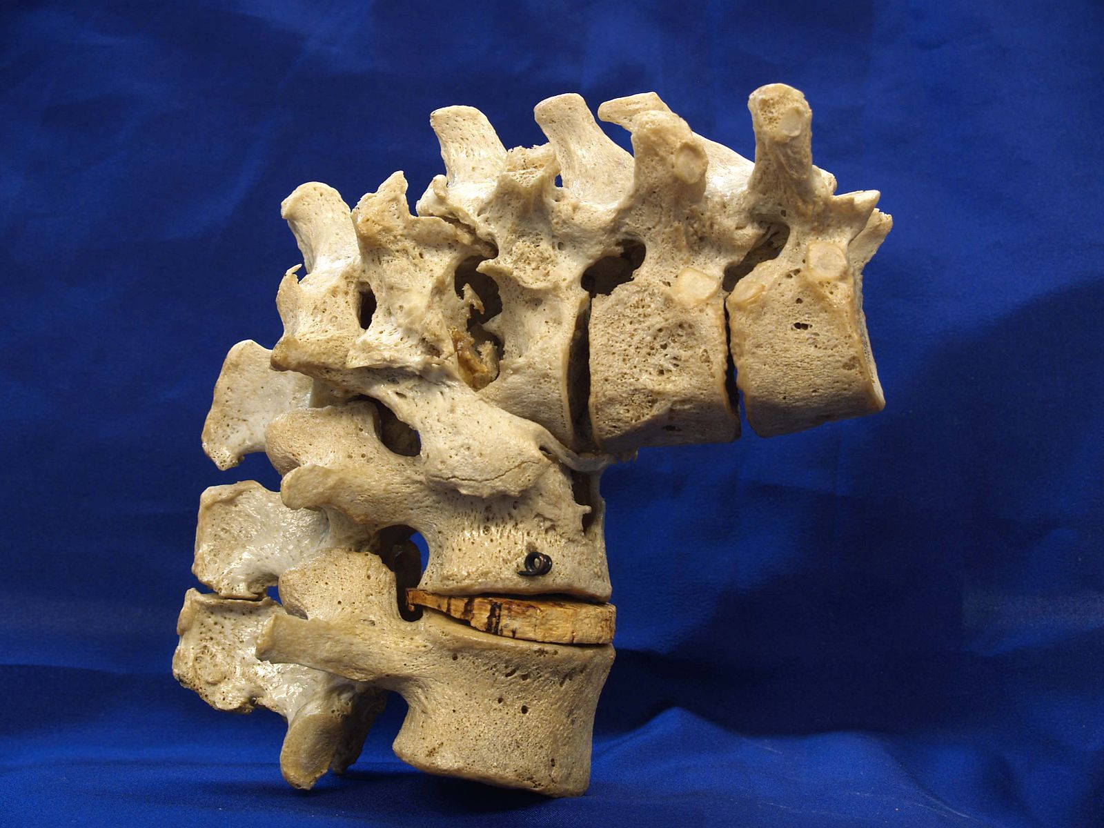 Atmore AL Affordable Back Pain Natural Relief