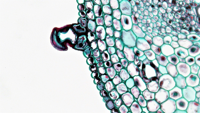 Reprogrammed’ stem cells could fight Parkinson’s disease